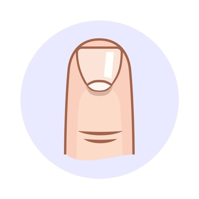 1749586811 653 6 Coisas que a forma das unhas revela sobre voce Foto: Incrivel.club