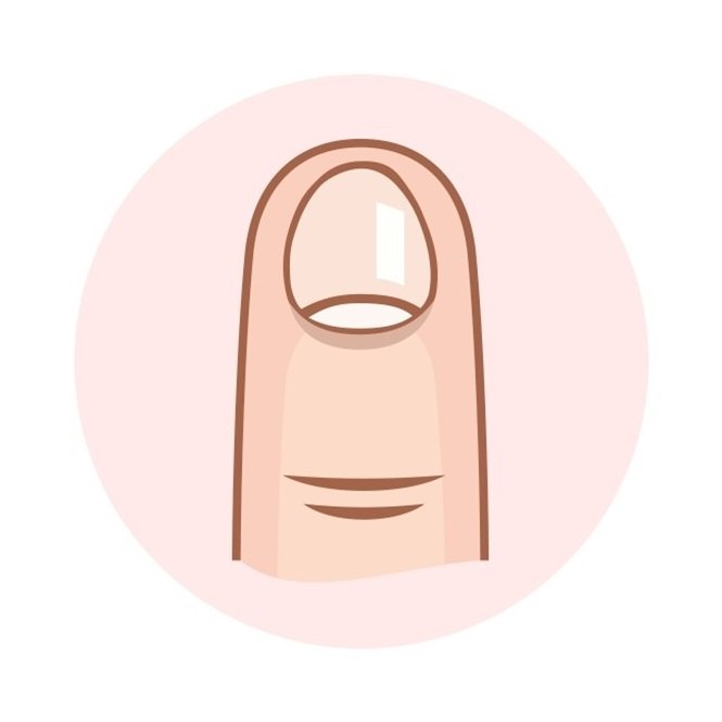1749586811 919 6 Coisas que a forma das unhas revela sobre voce Foto: Incrivel.club