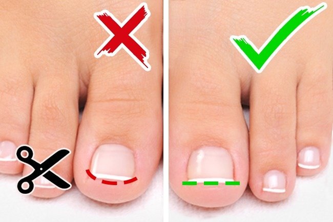 1749592777 444 6 Dicas para deixar os pes impecaveis blank