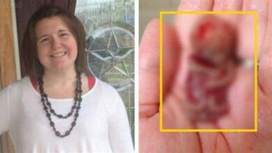 Mulher sofre aborto espontâneo e posta foto do bebê de 11 semanas com uma mensagem chocante, veja