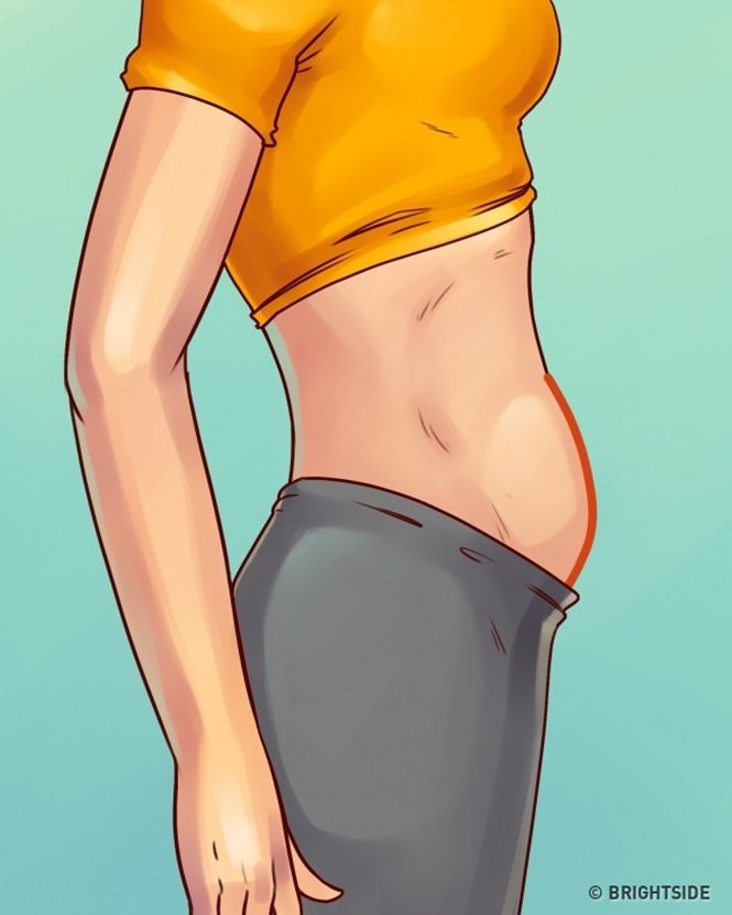 5 tipos de barriga que não são causados pelo excesso de peso
