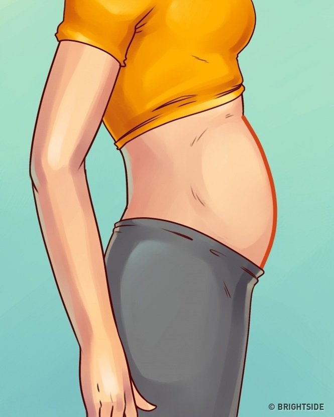 5 tipos de barriga que não são causados pelo excesso de peso