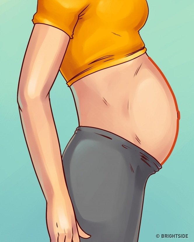 5 tipos de barriga que não são causados pelo excesso de peso