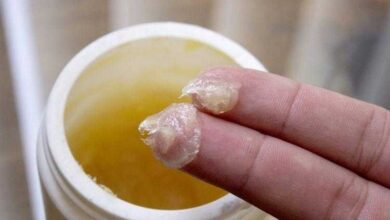 Como fazer seu próprio bálsamo caseiro para tratar a dor dd