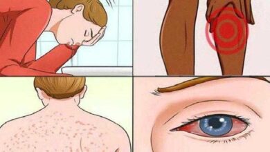 15 sinais de que o mofo está em sua casa e está destruindo seu corpo