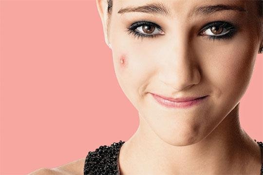 1749681327 72 5 coisas que voce pode fazer com o desodorante e espinha