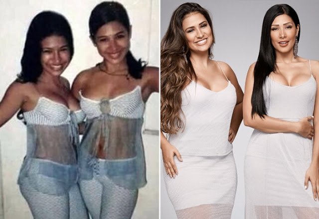 1749681866 503 13 celebridades brasileiras quando ainda eram anonimas blank