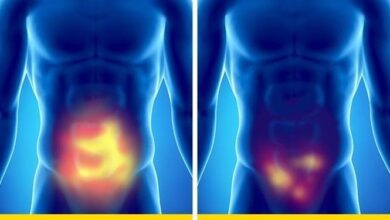 8 sinais que indicam que você precisa tirar férias