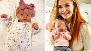 Mãe compartilha sua “visão” honesta de seu bebê com síndrome de Down e emociona a Internet