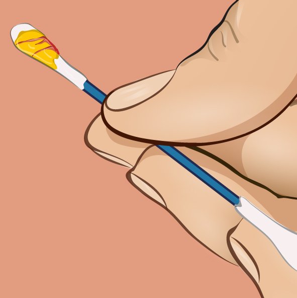 1749706987 127 A cor da cera dos ouvidos dizem bastante sobre a