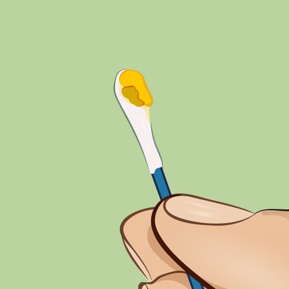 A cor da cera dos ouvidos dizem bastante sobre a sua saúde A cor da cera dos ouvidos dizem bastante sobre a sua saúde