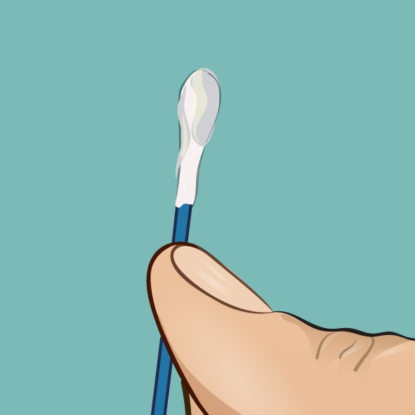 1749706987 48 A cor da cera dos ouvidos dizem bastante sobre a