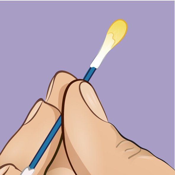 1749706987 649 A cor da cera dos ouvidos dizem bastante sobre a