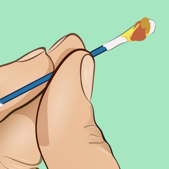 1749706987 947 A cor da cera dos ouvidos dizem bastante sobre a