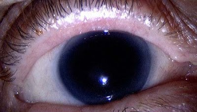 1749733388 32 As 5 cores de olhos mais raras do mundo olhos pretos