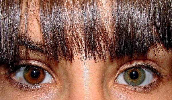 1749733388 531 As 5 cores de olhos mais raras do mundo heterocromia