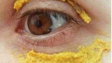 1749736271 Beneficios de aplicar acafrao em volta dos olhos Benefícios de aplicar açafrão em volta dos olhos 00S