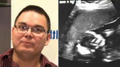 Marido desmaia ao ver o ultrassom – então eles olham os médicos e dizem “1 em 15 milhões”