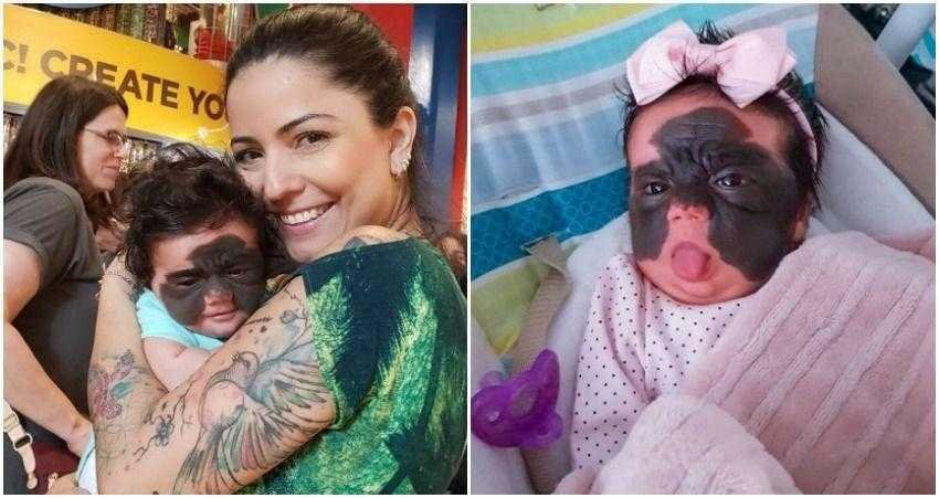 Bebê é chamada de monstro por causa de sua aparência e mãe desabafa d d