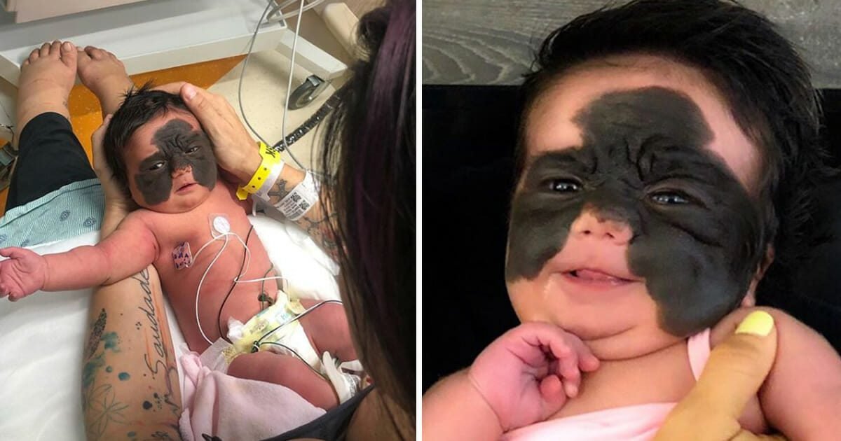 bebê é chamada de monstro por causa de sua aparência e mãe desabafa s