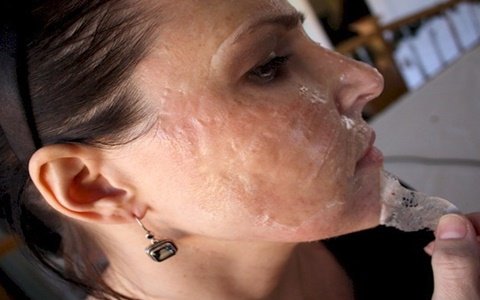 1749894312 87 Como ACABAR com CRAVOS com apenas DOIS ingredientes