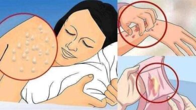 Você pode estar com HIV sem saber! Veja quais são os sintomas