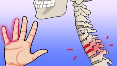 7 motivos que explicam porque você sente formigamento nas mãos