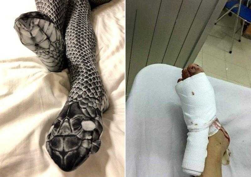 Mulher usa meia-calça diferente, assusta o marido e vai parar no hospital 1