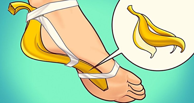 1750304178 549 Casca de banana 9 utilidades que voce nao conhecia