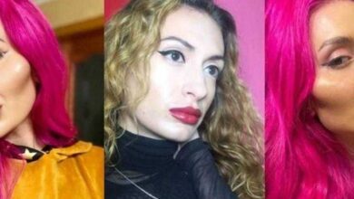 1750305215 Mulher viciada em preenchimento fica irreconhecivel apos mudanca bizarra Mulher viciada em preenchimento fica irreconhecível após mudança bizarra