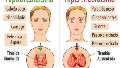 14 sinais que indicam problemas na tireoide