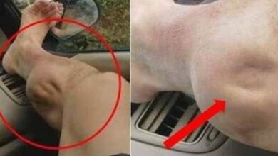 Câimbra: aprenda 3 receitas caseiras que acabam definitivamente com esse mal