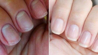 Tratamentos caseiros para fortalecer as unhas