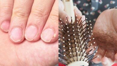 Deficiência de zinco: 30 sinais chocantes, fiquem atentos