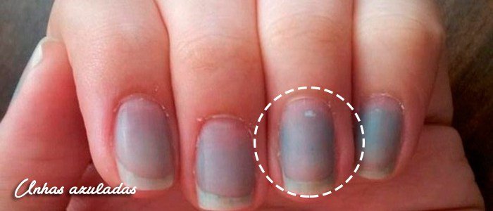1750383329 211 Suas unhas se encontram com algum destes aspectos CUIDADO para unhas8