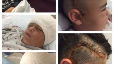 Garoto de 10 anos estava agindo estranho após ter brincado na rua. 2 dias depois, o que a mãe viu na cabeça dele a deixou desesperada!