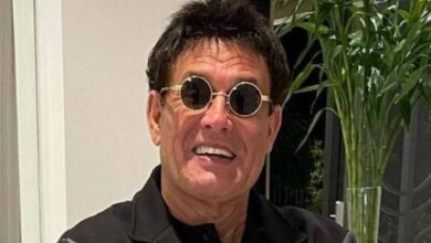 Sérgio Mallandro faz post quase irreconhecível após harmonização facial, e fãs reagem: ‘A cara da Gretchen’