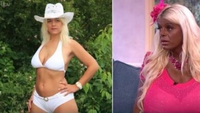 Garota viciada em plásticas faz bronzeamento e fica irreconhecível