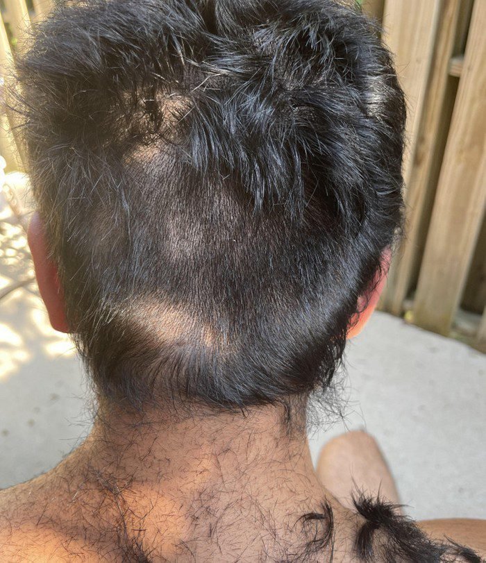 32 Garotas que só queriam ficar mais bonitas, mas alguma coisa deu MUITO errado