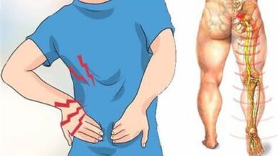 Nervo Ciático Inflamado – Sintomas E Tratamento