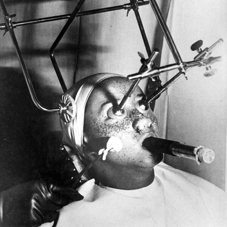 1750407727 610 18 tecnicas de beleza assustadoras que os antigos usavam e