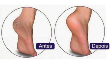 1750419854 receita para acabar com as rachaduras nos pes e mante los Receita para acabar com as rachaduras nos pés e mante-los macios