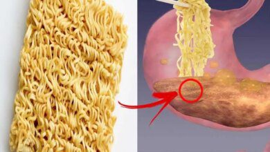 Miojo uma grande ameaça a nossa saúde! VEJA O QUE ELE PODE CAUSAR!