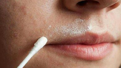 Receita caseira para depilar o buço para sempre