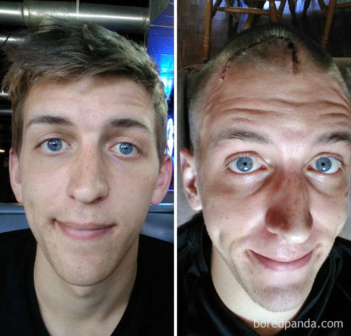 1750445365 477 10 antes e depois de pessoas que venceram o cancer