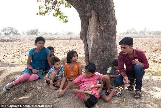 Gêmeos siameses de 12 anos