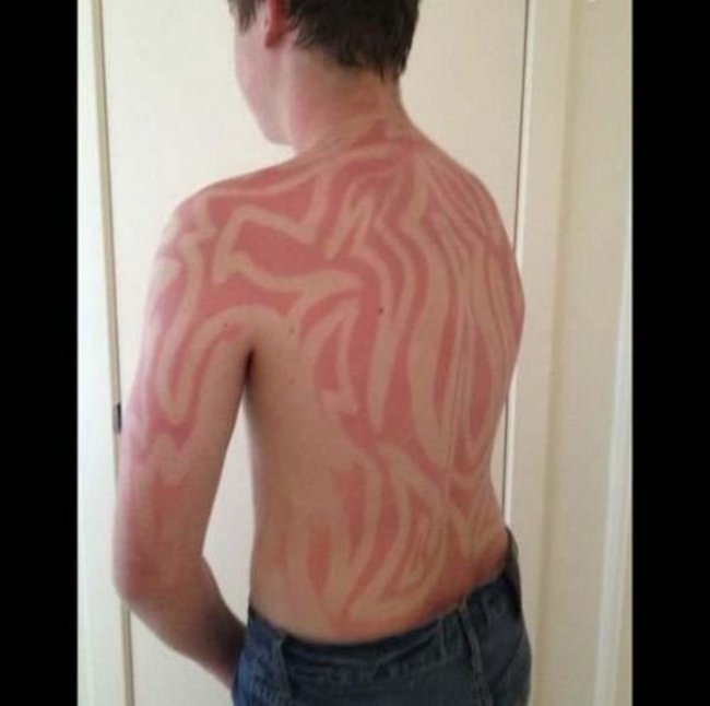 5-18-pessoas-que-esqueceram-o-quanto-as-marcas-de-sol-podem-ser-constrangedoras-as-vezes