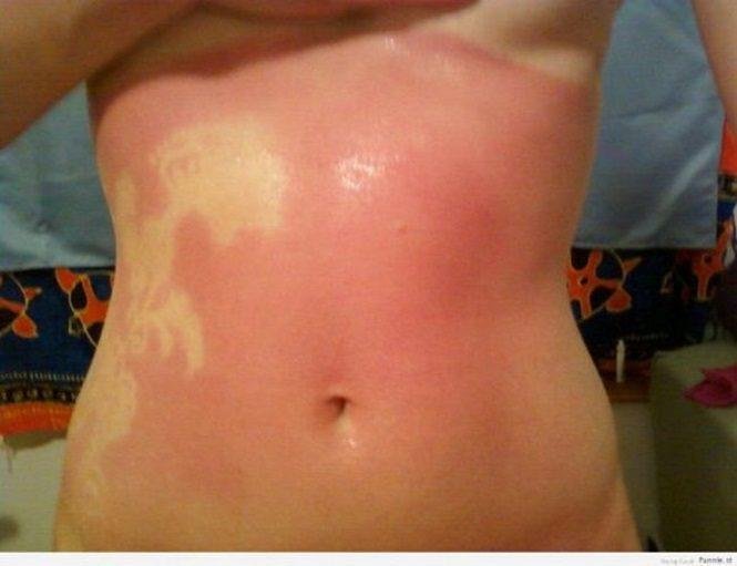 17 Pessoas que esqueceram o quanto as marcas de sol podem ser constrangedoras aa