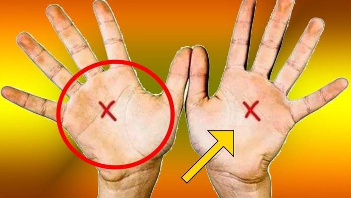 Listras nas Mãos Listras nas Mãos