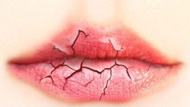 1750470429 labios ressecados veja 3 formas de deixa los hidratados Lábios ressecados? Veja 3 formas de deixá-los hidratados